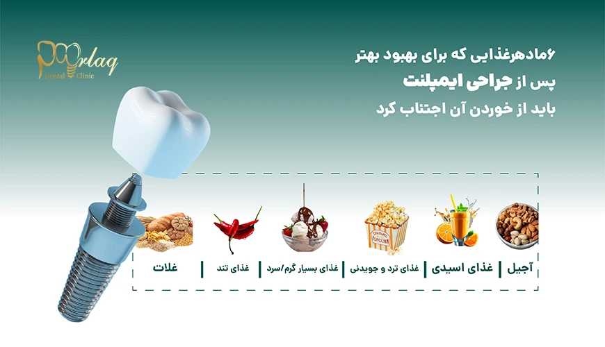 بهبود بهتر ایملنت