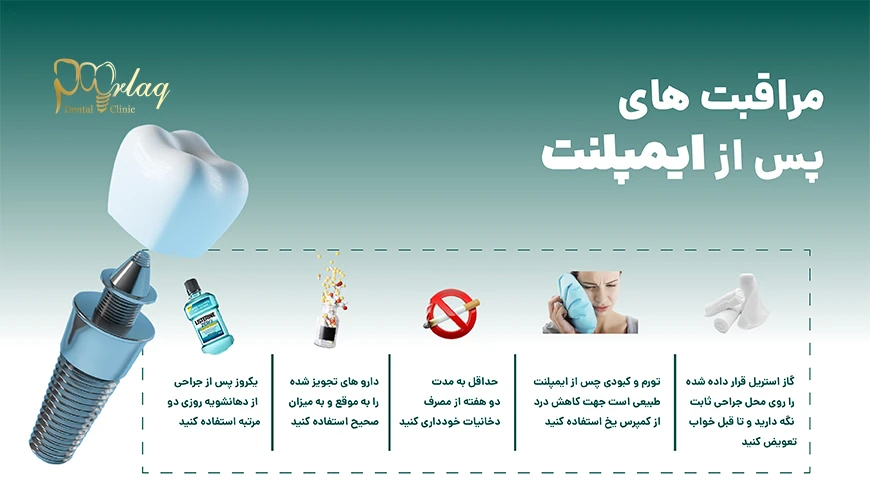 مراقیبت های پس از ایمپلنت